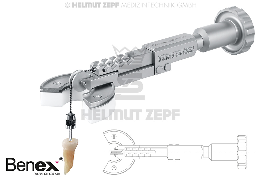 EXTRACTEUR BENEX NOUVEAU  